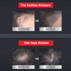Alpecin Caffeine Shampoo 250ml For Prevent Hair Loss Strengthen Hair