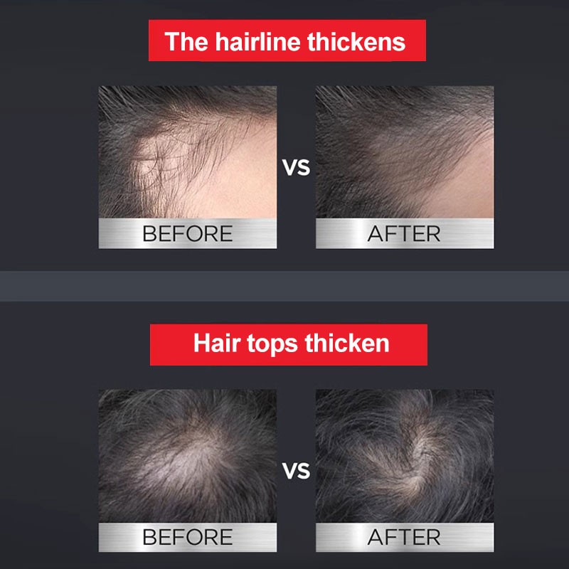 Alpecin Caffeine Shampoo 250ml For Prevent Hair Loss Strengthen Hair