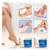 Crema De Varices Para Piernas, Cuidado Hidratante De La Piel