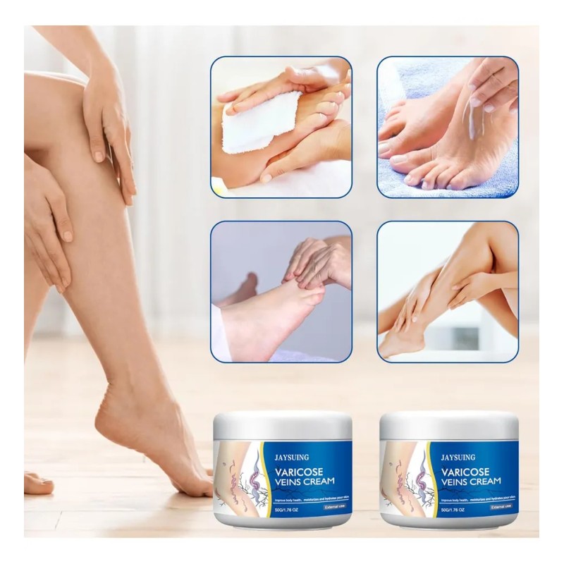 Crema De Varices Para Piernas, Cuidado Hidratante De La Piel