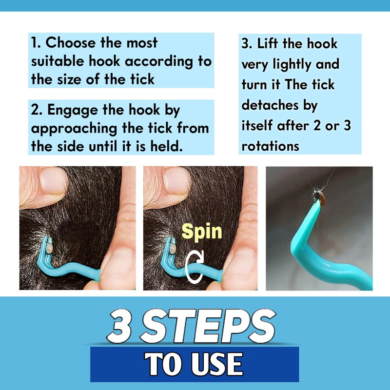 YANAM 4 Pack Tick Remover Tool Set, Tick Removal of