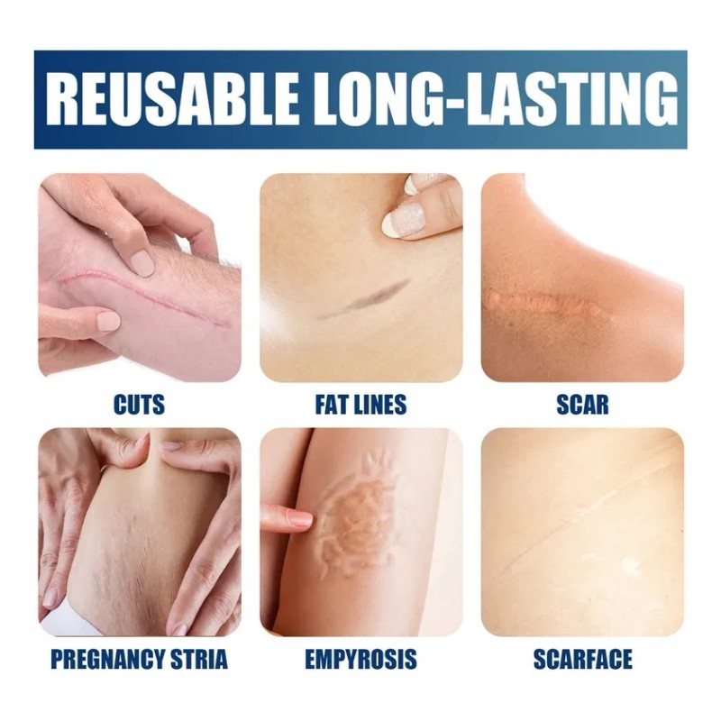 Jo Gel For El Cuidado De La Piel 1 Unidad