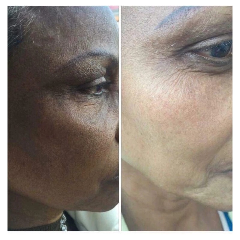 Jacvon LLC Skin Lightener Cream: Para Piel Morena o India