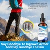 Ingrown Toenail Treatment Drops - Plant-Based Softener Solution