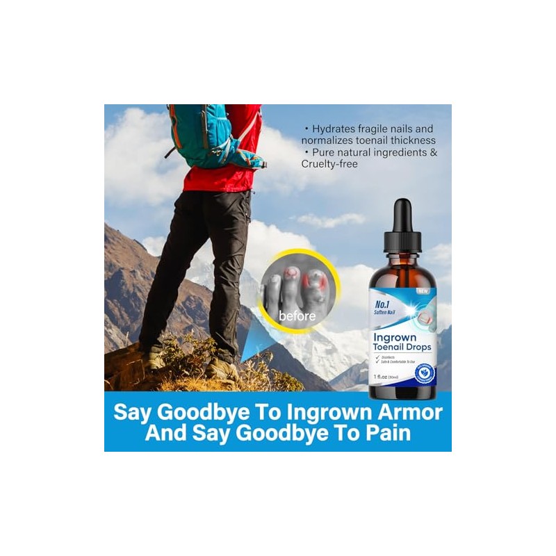 Ingrown Toenail Treatment Drops - Plant-Based Softener Solution