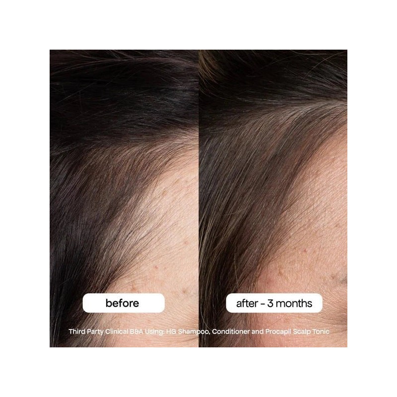 BondiBoost HG Procapil Hair Tonic 125ml