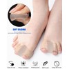 JUKOTA 4 Stück Zehenspreizer Hallux Valgus,Gel Zehentrenner mit 2 Schlaufen,Hallux