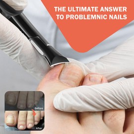 BEZOX Toenail Clippers for Seniors Thick Toenails - Precision Large Thick Nail Clipper for Men and Women, Comfort Grip Fingernail Clipper, Ergonomic Long Handle Nail Cutter Trimmer with Catcher