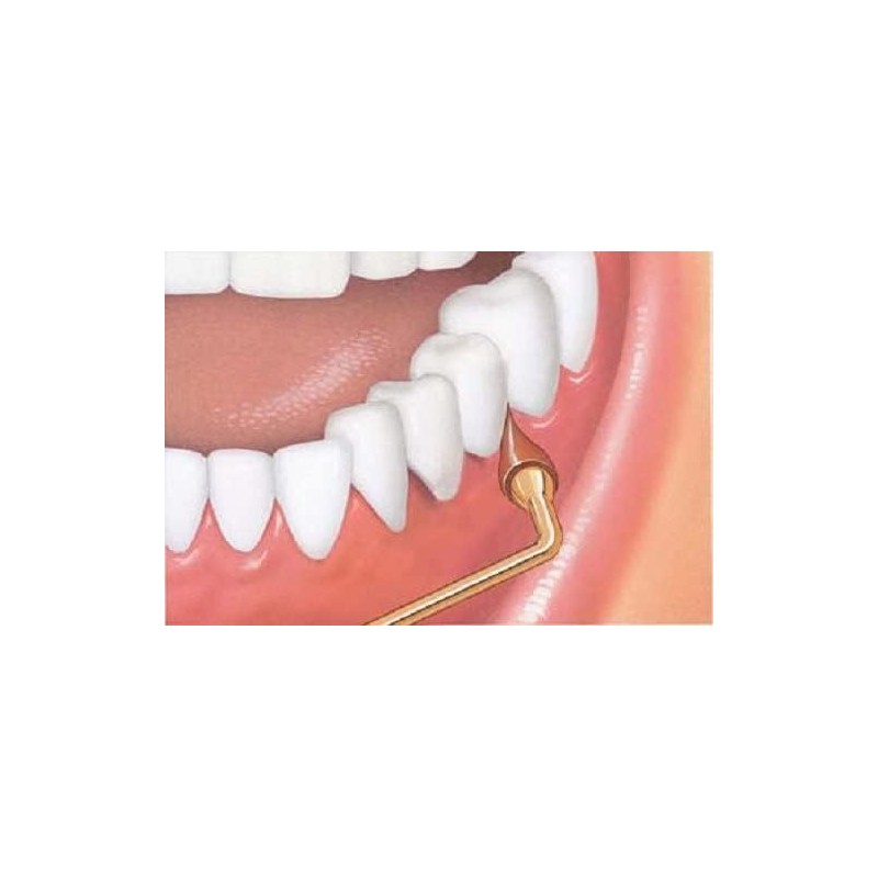 GUM Stimulator Permanent Handle - 1 Rubber Tip Included -