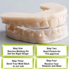 Custom Clear Retainer, Dental Retainer for Adults & Teens, Slim,