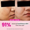 Dot & Key Watermelon 10% Glycolic Serum for Face Glowing,