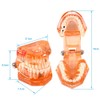 Dental Model Dental Model, Removable Dental Implant Teaching Model Dentist