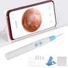 Ear Wax Removal Endoscope Otoscope WIFI Connected Ear Camera Cleaning