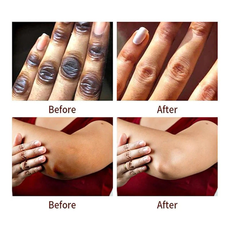 Serum Blanqueador Axilas Zonas Intimas Codos Rodillas 50ml Todo Tipo