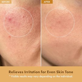 TOSOWOONG Crema de Arroz Real Glow, Hidratante Facial con 42% de Agua de Salvado de Arroz, Ácido Hialurónico, 6 Ceramidas Nutrición Profunda, Reparaci