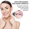 SSKHE Pack of 28 Teeth Whitening Bands, 9D Teeth Whitening