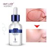Acido Hialuronico Puro Con Concentrado B5 Rorec Serum Regene Tipo