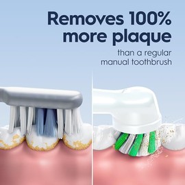 Oral-B Cepillo de dientes eléctrico recargable Pro 1000, color blanco