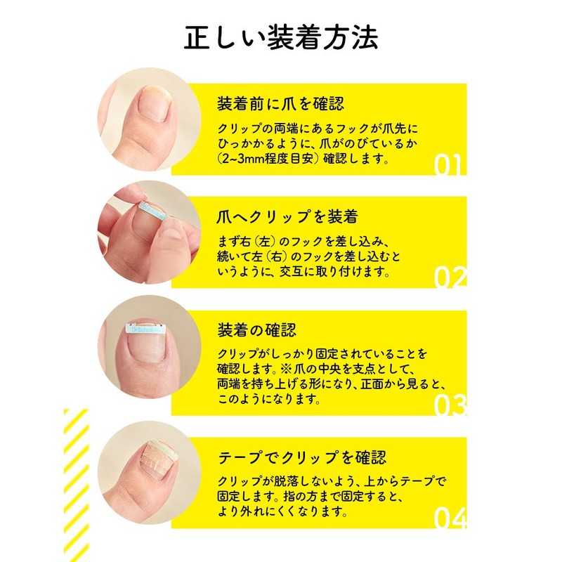 Dr. Shawl, Clip for Curling Claws, Medium Size x 2