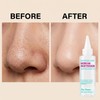 Super Melting Sebum Softener, Blackhead Remover Liquid for Deep Pore