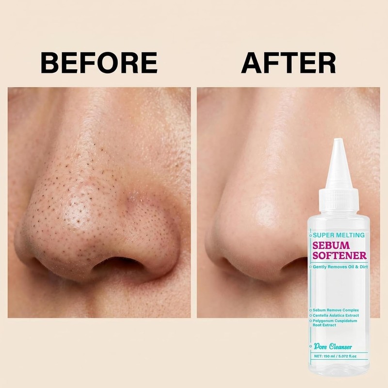 Super Melting Sebum Softener, Blackhead Remover Liquid for Deep Pore