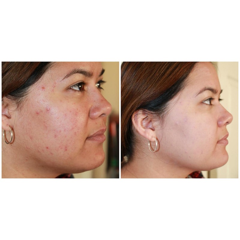 Judith August - EraseZit Deluxe Pencil - (Neutral)