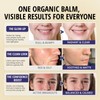 Bealions Organics Acne Killer Night Balm, 30g