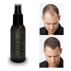 Hacer Crecer El Pelo Rápido Urgente Novocrin Loción 100ml