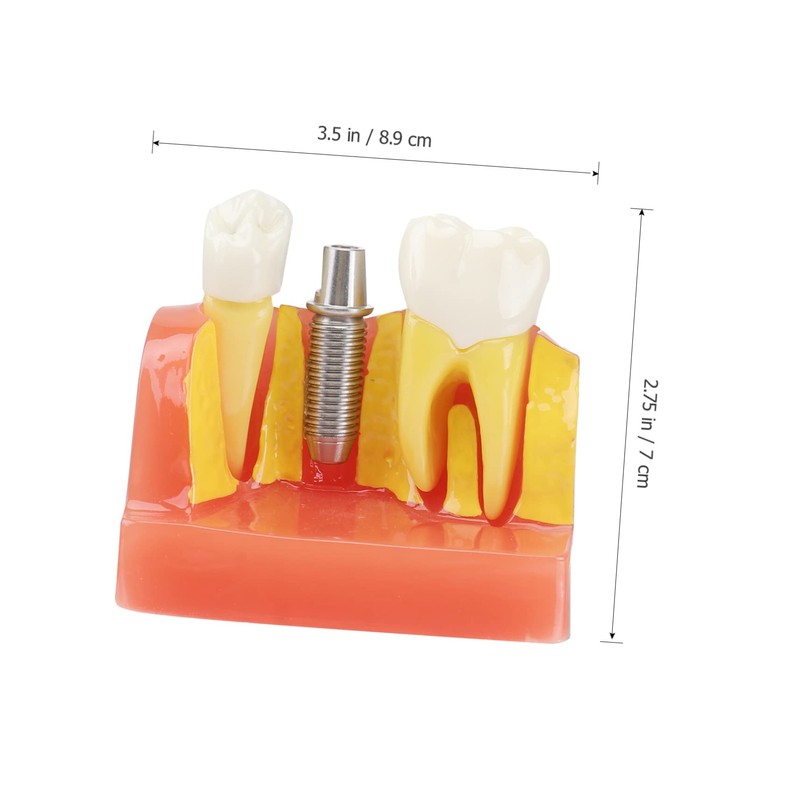 Gatuida 1pc Tooth Model Learher Gronwn Ups Teeth Teaching Model