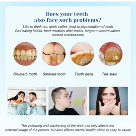 2 Pcs Teeth Whitening Pen,Teeth Whitening Kit,Teeth Whitening Pen Gentle,Fast Teeth Whitening Improve Dental Brightening,Fast and Effective Removal Tooth Stain Removal