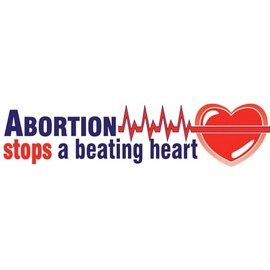 Abortion Stops a Beating Heart Pro-Life Bumper Sticker