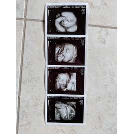 Prank 3D Customized Fake Ultrasound Strip of 4 Photos