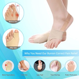 Tailor Bunion Corrector, Bunion Pads for Bunion Pinky Toe Relief, Tailors Bunion Splint for Toe Straightener, Little Toe Separator, Overlapping, Soft Silicone Gel Bunion Pad With Anti-Slip (S)