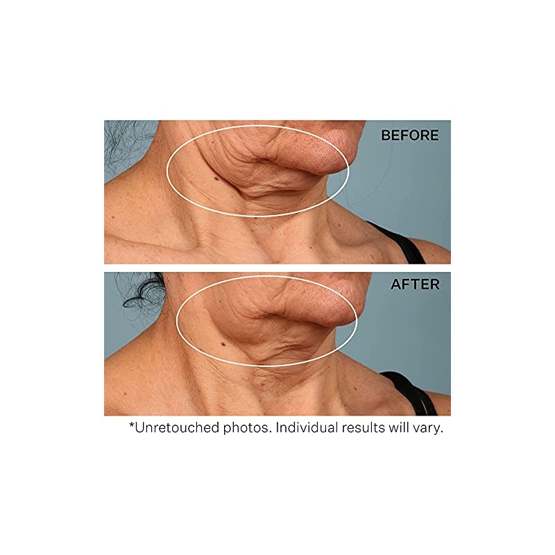 StriVectin, Crema para Cuello para apretar y levantar, 30 ml