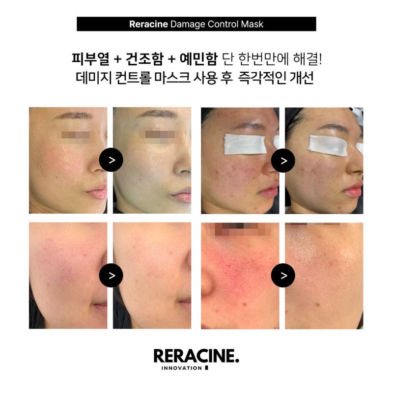 Lyricin (10 sheets+10 sheets) Lyricin Mask Damage Control Soothing Mask
