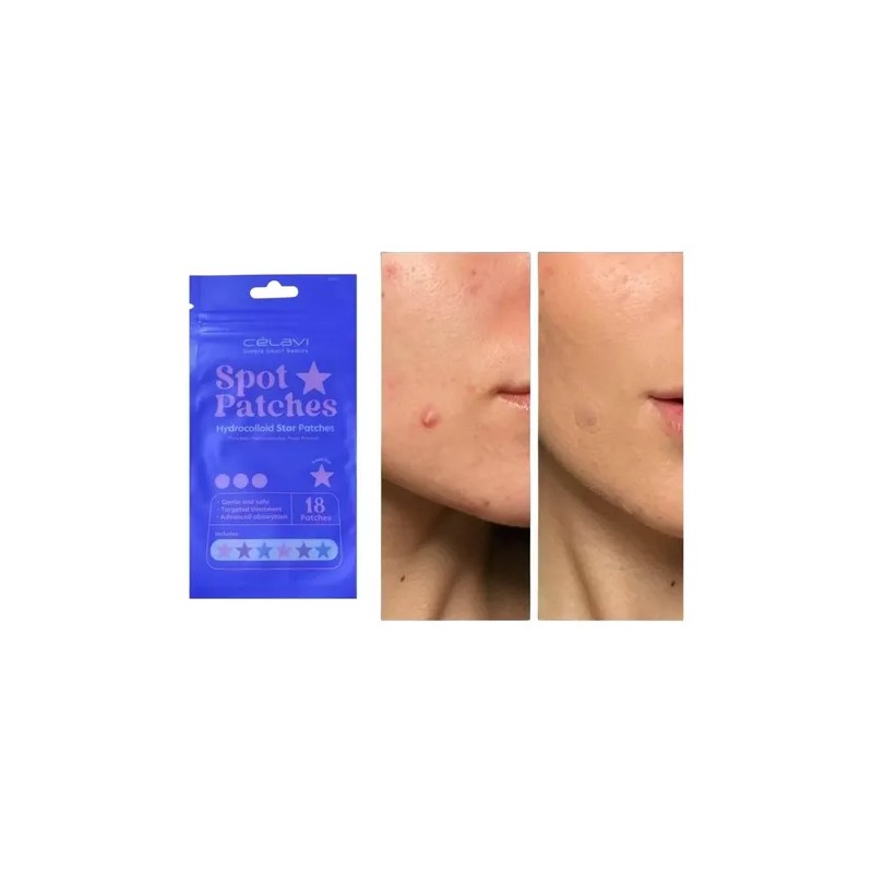 Parches Antiacné Celavi Hydrocolloide Día Noche 18 Pzs Todo Tipo