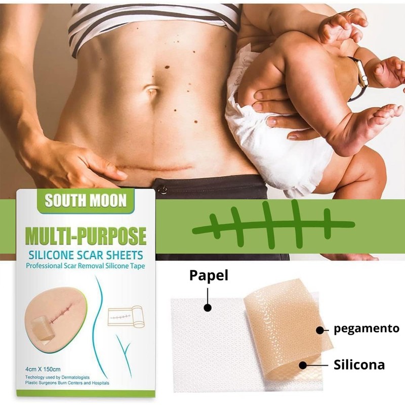 2 Rollos Cinta Silicona Reparación Cicatrices Marcas Piel Silicona Suave