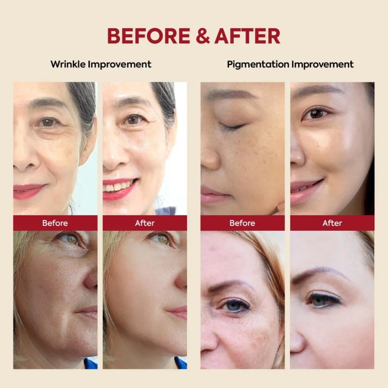 Jy Hidratante Reafirmante Para Ojos Crema Para Ojos Que Aten