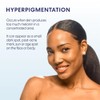 Palmer's Skin Success Fade Milk - Loción Corporal Aclarante, Dermatológicamente
