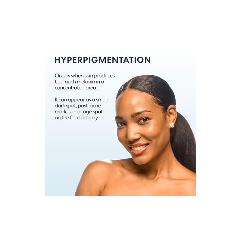 Palmer's Skin Success Fade Milk - Loción Corporal Aclarante, Dermatológicamente