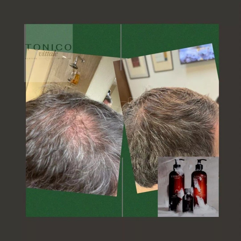 Tonico Vittale Crema Para Peinar Cabello Reparador Sellador Tonico Vittale
