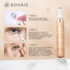 RONKIE Eye Cream for Dark Circles: Under Eye Cream with