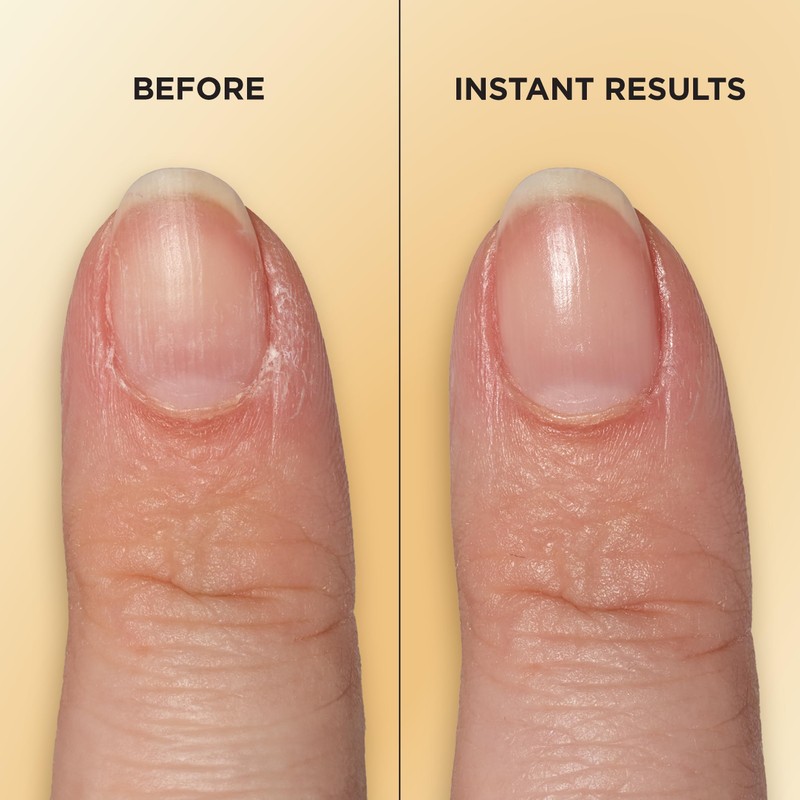 Sally Hansen Vitamin E Nail & Cuticle Oil Pen, Trattamento