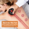 cotsoco Original 5-in-1 Cupping Kit for Massage Therapy, 20 Suction