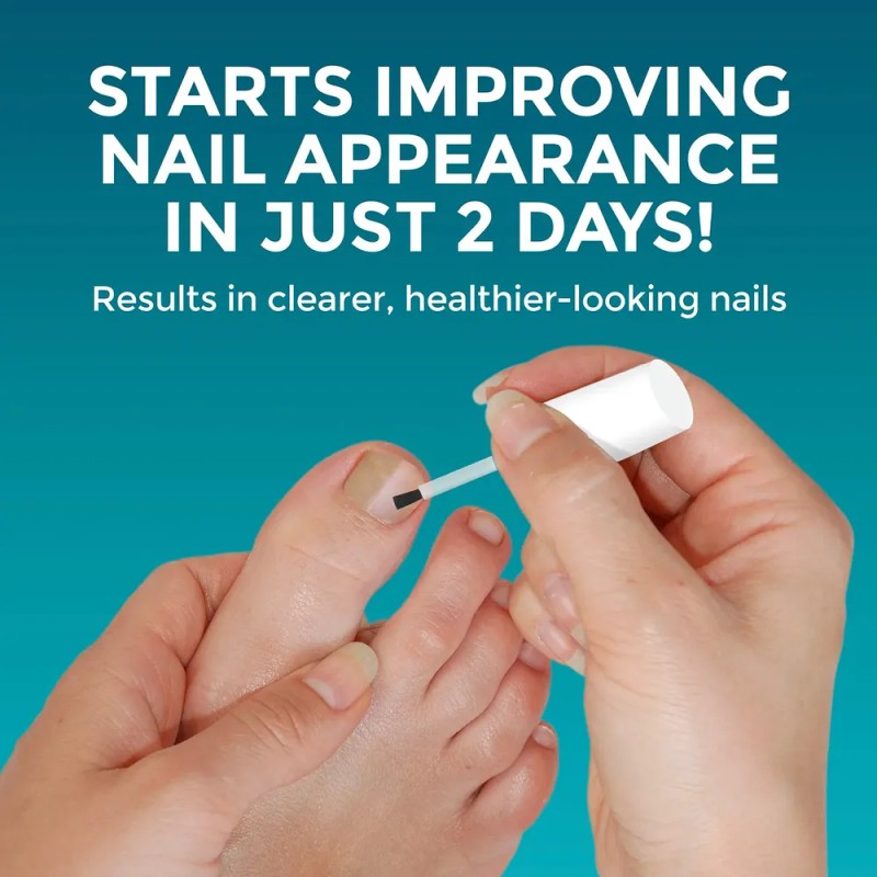 Reparador De Uñas Fúngico Opti-nail Restaura Una Apariencia