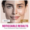 Arbutin 8% + Tranexamic Acid 5% Cream, Professional Arbutin Cream