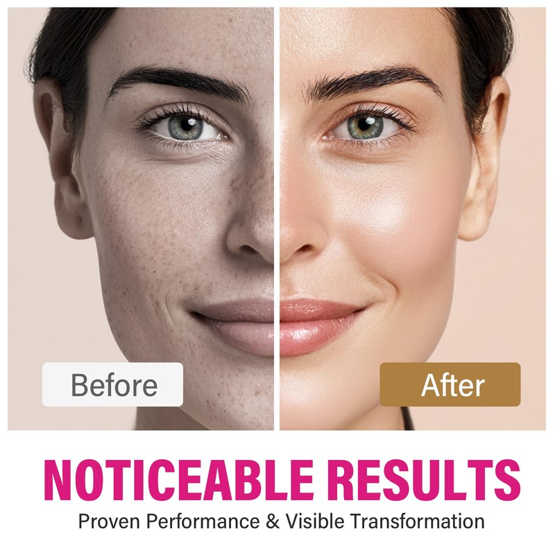 Arbutin 8% + Tranexamic Acid 5% Cream, Professional Arbutin Cream