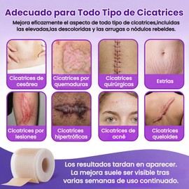PUBUNUS Parches Cicatrizantes, Cinta de Silicona para Eliminar Cicatrices, Médico Profesionales, Cicatrices Reutilizable Causadas por Cesárea, Cirugía, Quemaduras, Queloides, Acné (4CM*3M)