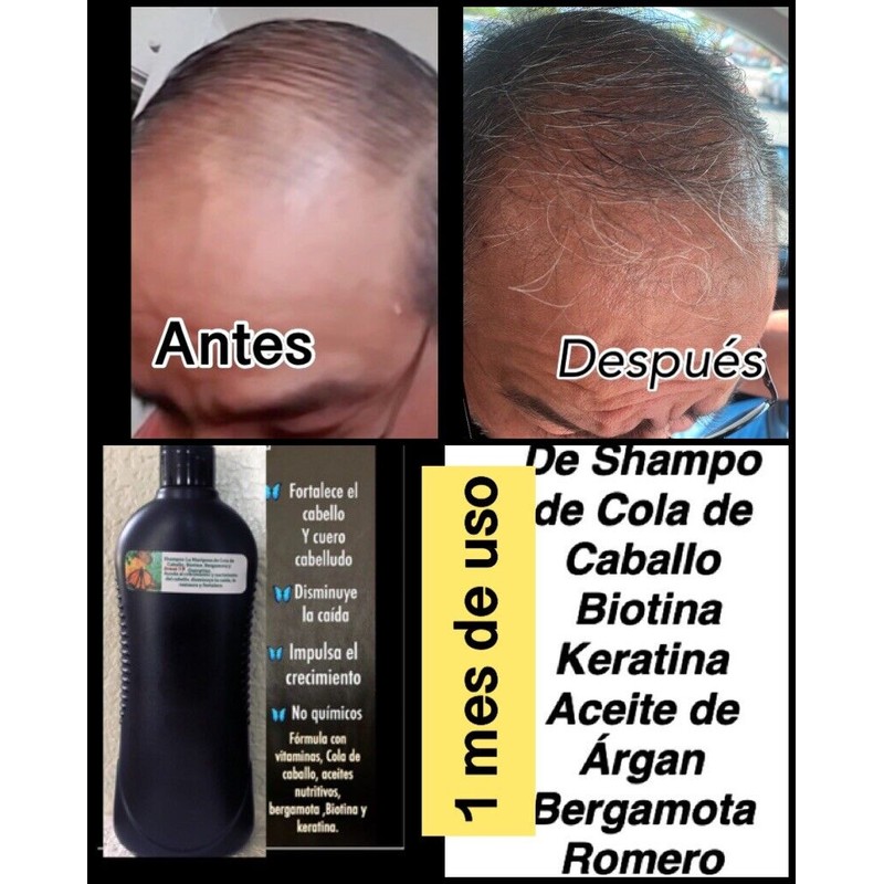 Shampoo De Cola De Caballo, Romero Aloe Vera Crecimiento De