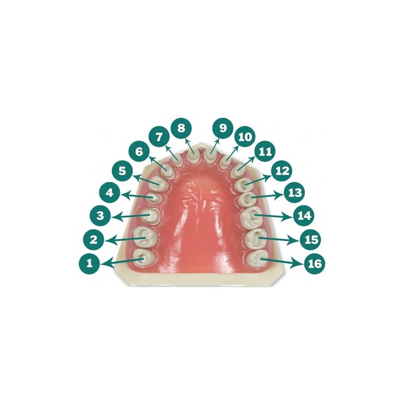 Typodont 860 Prep Replacement Teeth with Crowns and Cavities 5
